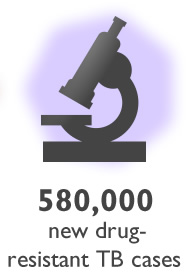 Graphic of a microscope. 580,000 new drug-resistant TB cases