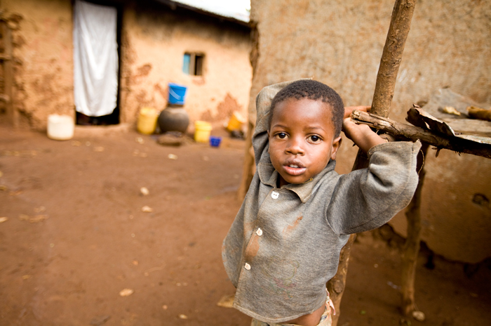 Photo of a child in Kenya who has HIV.