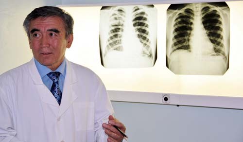 Dr. Shakimurat Ismoilov displays his patient’s X-rays.