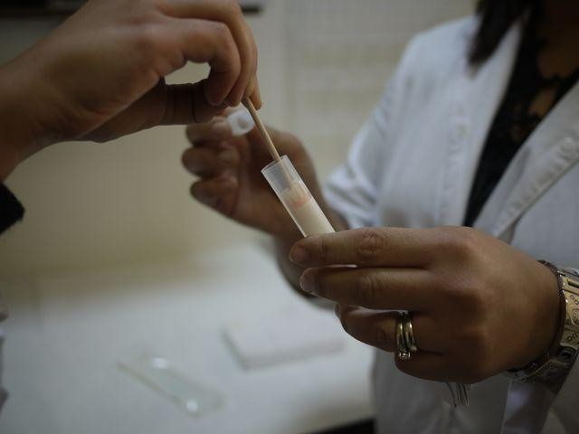 image of leishmaniasis saliva swab test being conducted