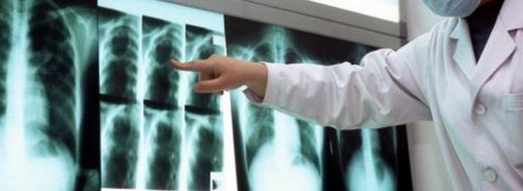 A medical technician points to a chest xray