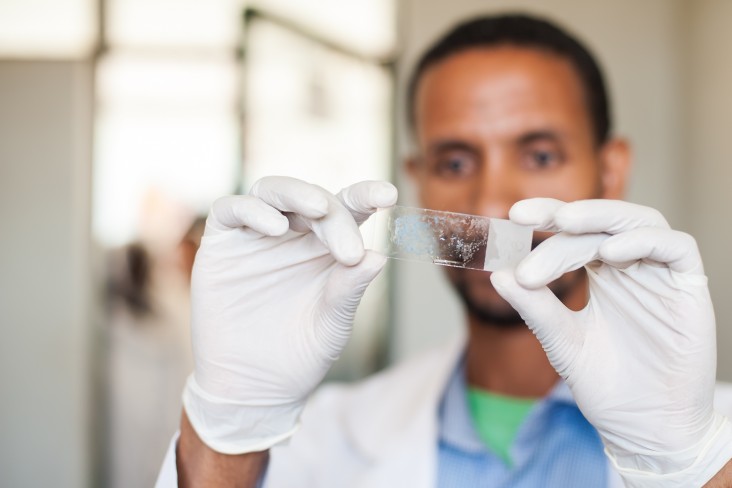 A HEAL TB-trained laboratory technician at the Lich Health Center in the Amhara Region examines a slide with sputum smear. The s