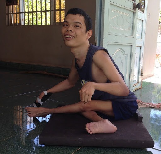 Nguyễn Minh Hào với ván trượt mới giúp anh di chuyển quanh nhà mà không phải bò như trước.