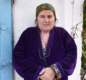 Shulabibi Ismatova stands in her yard following her recovery. The burns on her neck and chest are visible.