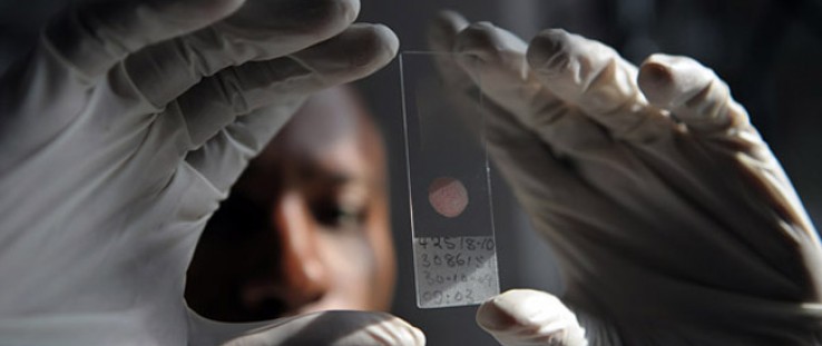 A laboratory technician prepares a sample for genotyping at the government-run Ifakara Health Institute in Bagamoyo, Tanzania, w