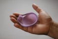 SILCS Diaphragm + a Contraceptive Gel, or TFV Gel