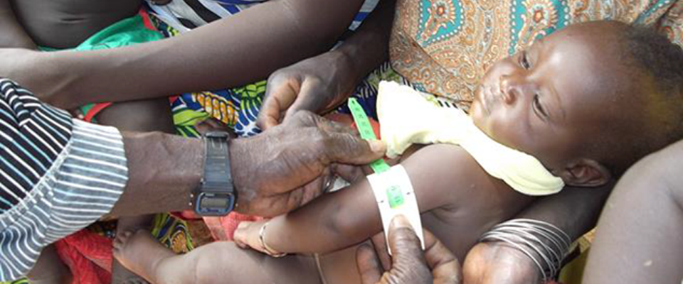 A child is screened for malnutrition