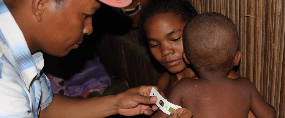 Madagascar malnutrition